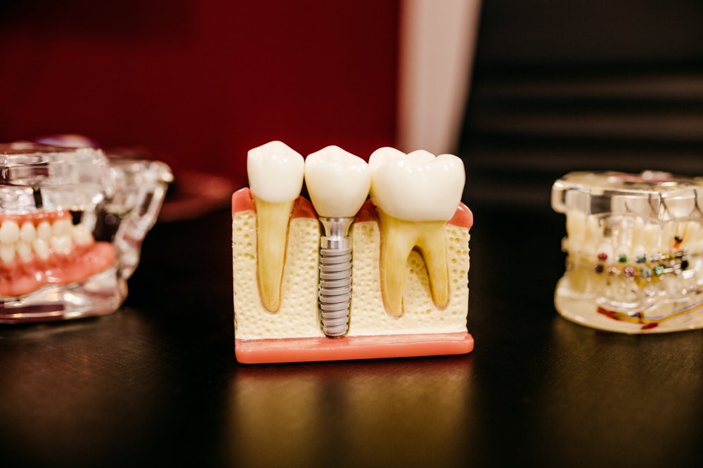 Tandläkare i Östermalm gör dina tänder snyggare